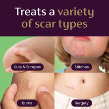 Load image into Gallery viewer, Mederma Scar Gel For Kids, Reduces The Appearance Of Scars, Grape Scent, 0.70 Oz